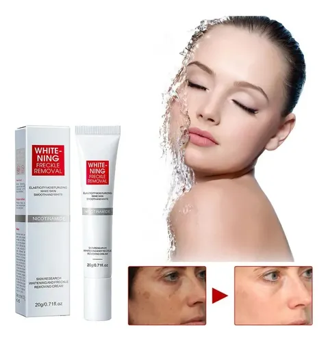 Eliminador De Manchas Oscuras 3d, Cloasma Nj Hx