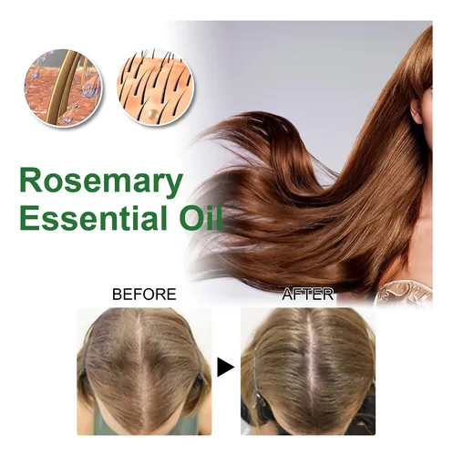 El Aceite Esencial De Romero For El Cabello Reduce La Caída