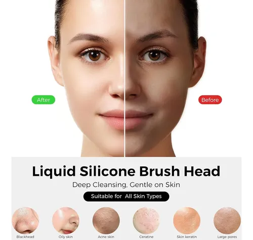 Cepillo Facial Eléctrico De Silicona Ccigedy Berry