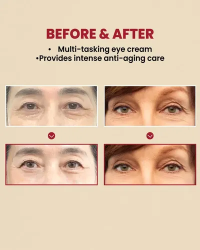 Ksecret Eye Cream : Retinal Liposome 4% +fermented Bean 30ml