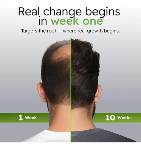 Kkidgtratamiento Nutritivo Para Cuero Cabello Tuinutriti