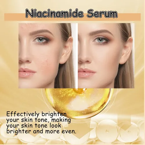 Sérum De Niacinamida Compatible Con Pieles Propensas Al Acné