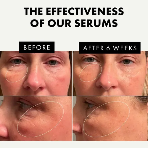 Sérums Faciales Eclat Skincare, Paquete De 3 Unidades De Vit