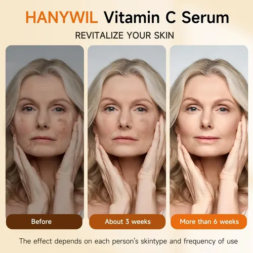 Jywil 20% Super Vitamin C Serum For Mature Skin, Targets Age Madura Día/noche