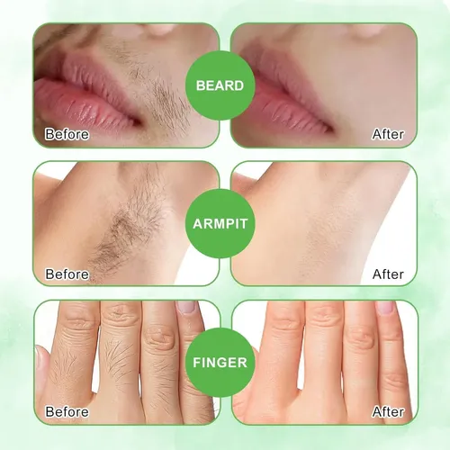 Bandas Faciales De Cera 98% Natural Weilnell Ws001 Verde