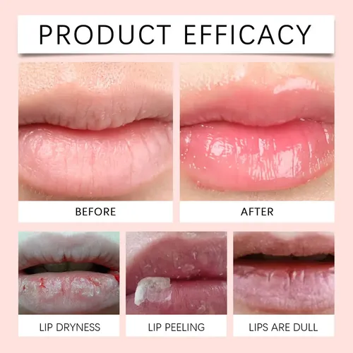 Bálsamo Labial Coloreado Hkjm, Suave E Hidratante, Suaviza Y