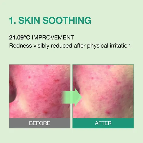 Essenherb Tea Tree Calming Cream For Acne-prone & Sensitive