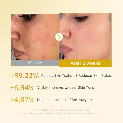 Tónico Medicube Resurfacing con Ácido Kójico y Cúrcuma para Todo Tipo de Piel