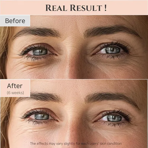 Sérum De Ojos Y Glow Korean Skincare De Beauty Of Joseon