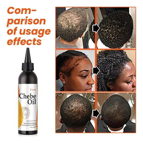 Aceite Para El Crecimiento Del Cabello Brzeaf Natural Chebe