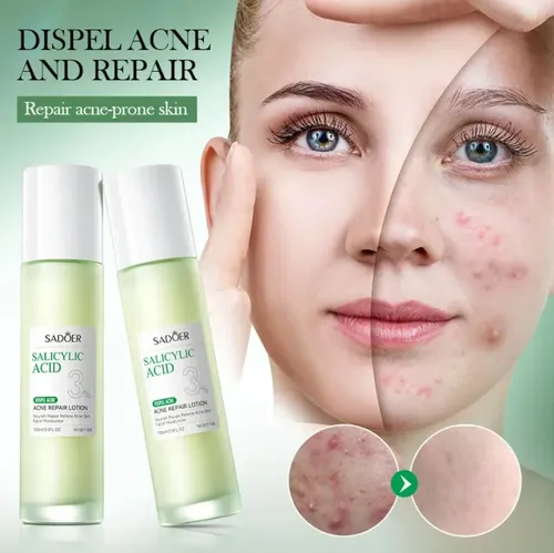 Loción Antiacné Sadoer Ácido Salicílico 3% Centella Asiática 100ml