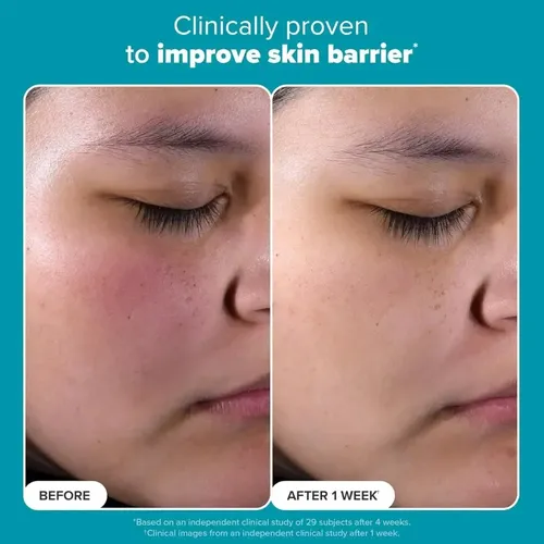 Exfoliante Líquido Perfeccionador De La Piel 2%