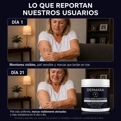 Dermara® Crema Corporal Para Piel Delicada 100gr Pack X4