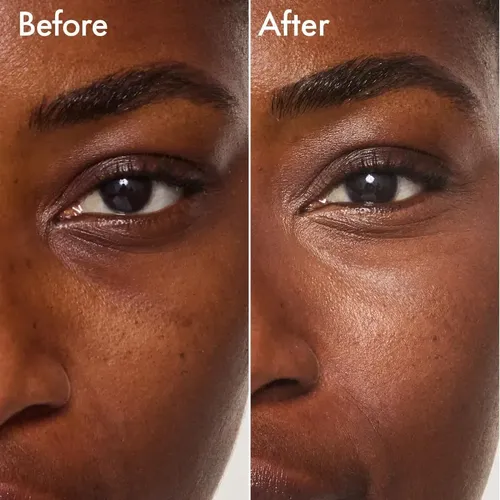 Corrector Ojeras Crema Iluminador Acido Hialuronico Catrice