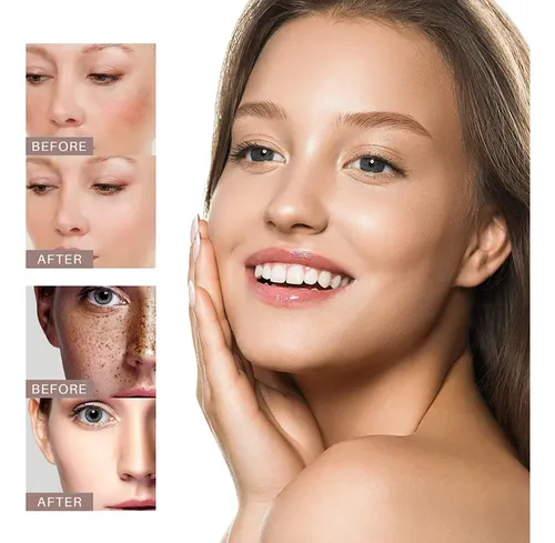 Crema Hidratante Para Manchas Que Se Decoloran, Nutre Y Mejo Todo Tipo De Piel