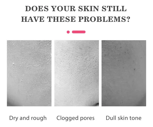 Barra De Mascarilla Facial De Barro 40g Limpieza Y Cuidado