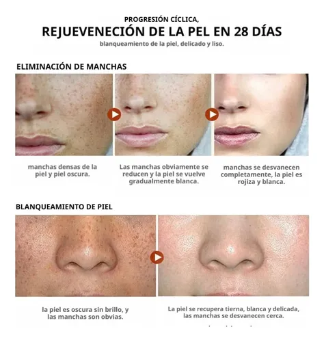 Crema Blanqueadora Para Manchas Oscuras, Antipecas,