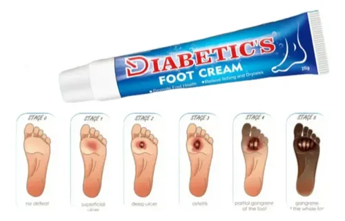 Qo,crema Ts Sumifun Con Dispensador Tc0 Para Pies Diabéticos