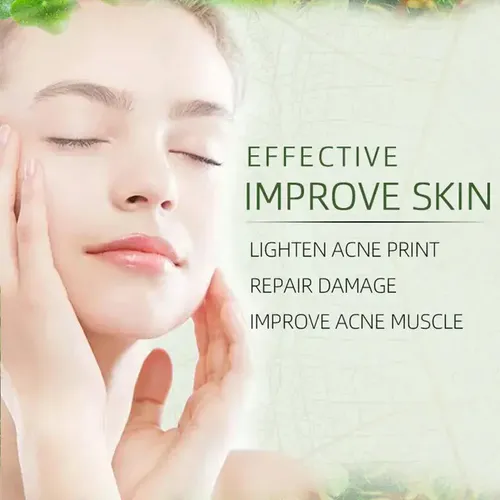 Crema Facial Eliminadora De Acné A Base De Hierbas Joypretty