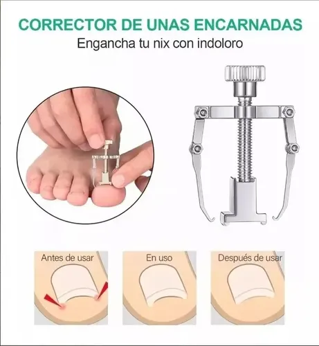 Pedicure Set De Manicure Profesional Cortar Uñas Encarnadas