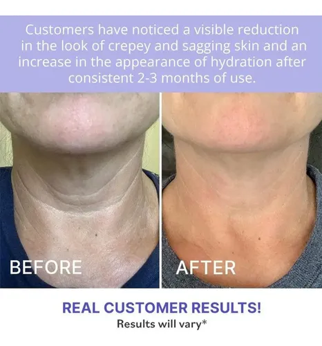 La Crema Reafirmante Antienvejecimiento Para El Cuello Tensa