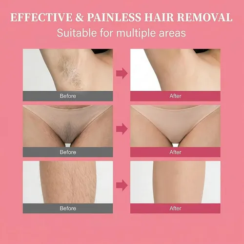 Crema Depilatoria Para Mujer, Indolora Y De Acción Rápida