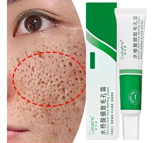 Crema Facial Con Ácido Salicílico 20ml Para Poros