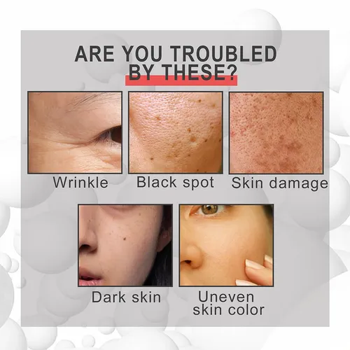 Loción Reductora Facial De Líneas Finas Eelhoe: Tensa La Pie