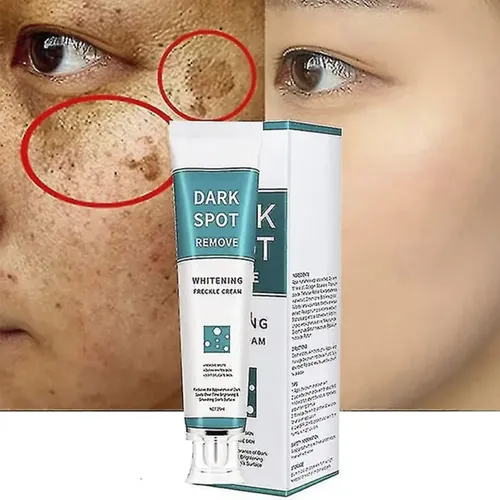 Crema Anti Manchas Oscuras 20ml Hiperpigmentación Facial