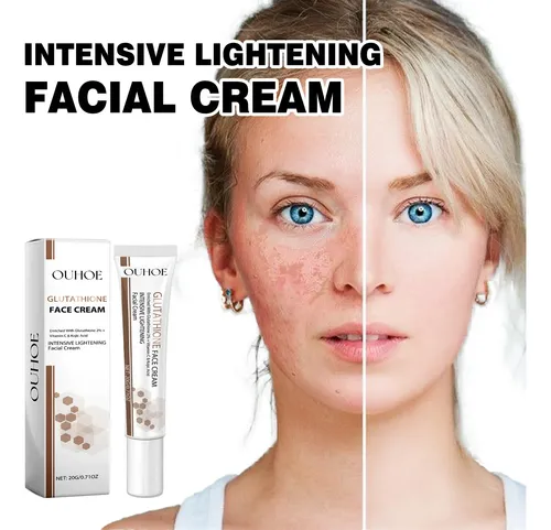 Crema Blanqueadora Hidratante For Aclarar Las Manchas