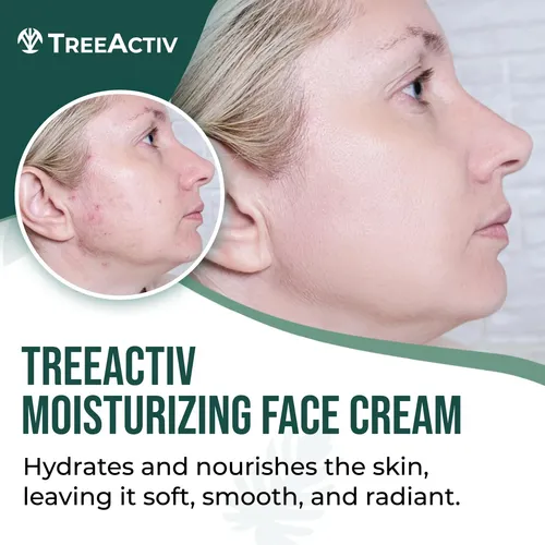 Crema Facial Antiacné Treeactiv | Fórmula Hidratante 2 Oz Seca