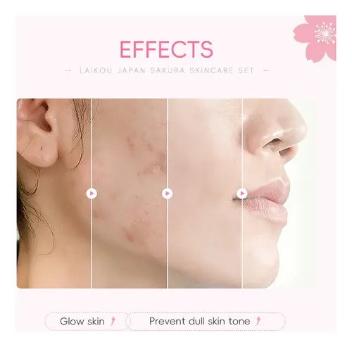 ~confiableset Laikou Sakura Skin Care Pro, Iluminador E .