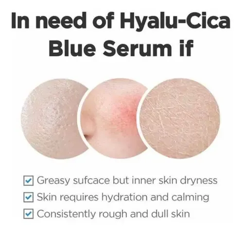 Skin1004 Madagascar Centella Hyalu Cica Blue Serum 50ml Momento De Aplicación Día/noche Tipo De Piel Todo Tipo De Piel