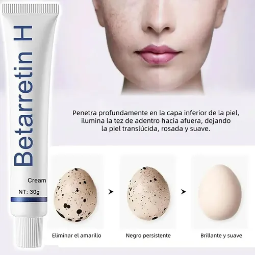 Creme Clareador, Creme De Hidroclorotiazida De Betametasona.