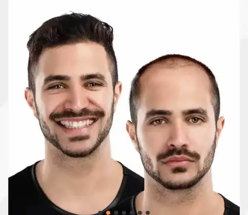 Prótesis Capilar Roma Hombre Base Piel Fina Natural Castaño Oscuro