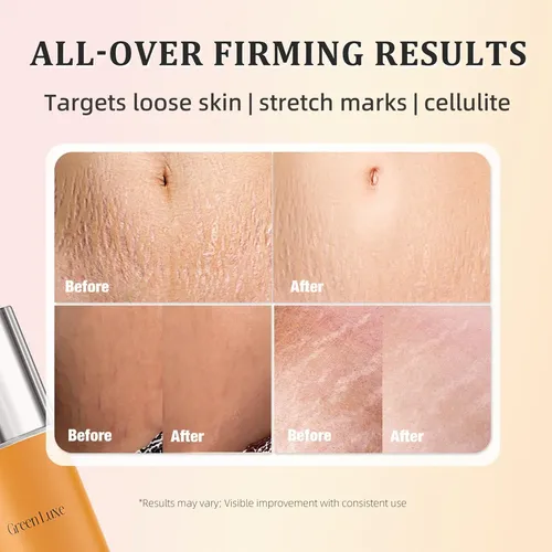 Crema Reafirmante Belly Firming