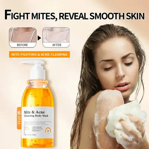 Gel De Baño Hz Para Eliminar Ácaros Y Acné Afaj