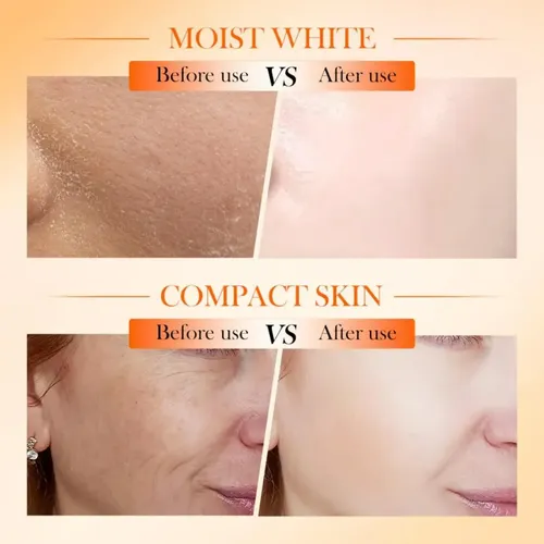Loción Facial Reparadora Quintuple Vitamina C 100ml Sadoer Todo Tipo De Piel Día/noche