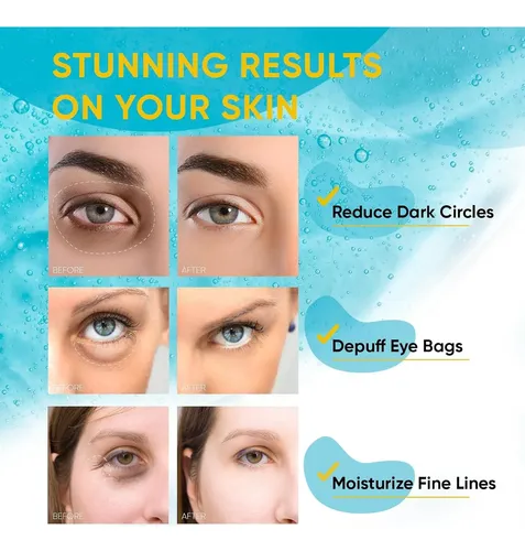 Parche Para Ojos Hidratantes Con Colágeno Y Retinol