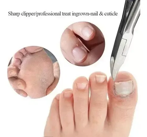 Tijeras De Acero Inoxidable Para Cortar Uñas Encarnadas Grue