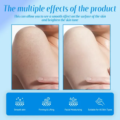 Crema Ximonth Para Queratosis Pilaris: Hidratante E Iluminad