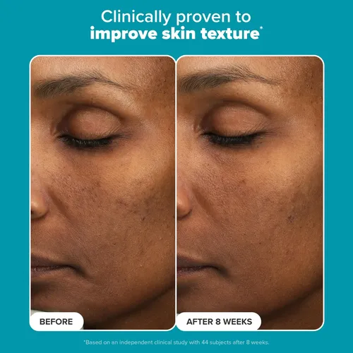 Exfoliante Paula’s Choice 6% De Ácido Mandélico Y 2% De Ácid