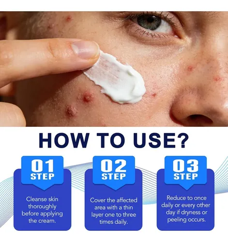 Crema Tratamiento 1% Ácido Salicílico Para Foliculitis