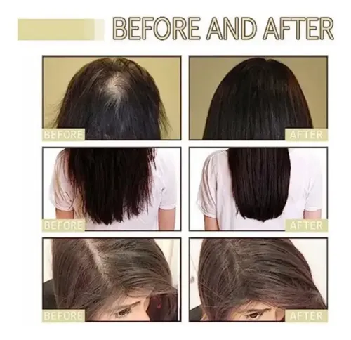 D 2pcs Aceite Esencial Para Cuidado Del Cabello Veganic D