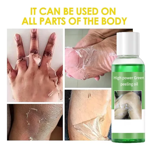 Aceite Exfoliante Genérico Extra Fuerte Para Piel Oscura 110