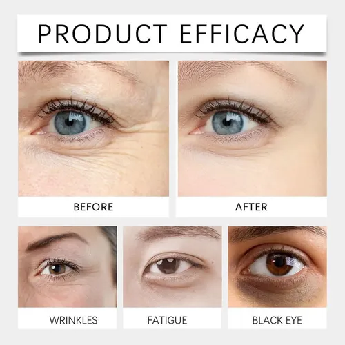 Aceite Antiarrugas De Luteína De 8 Ml Que Mejora Las Ojeras  Madura Día/noche
