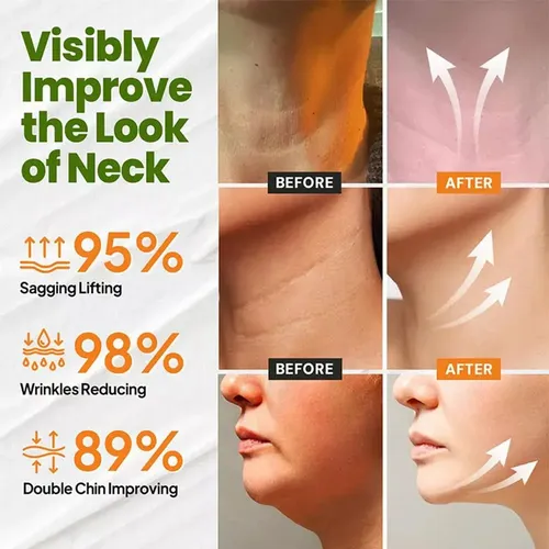 Crema Reafirmante Para Cuello, Efecto Tensor Y Elevador,,;