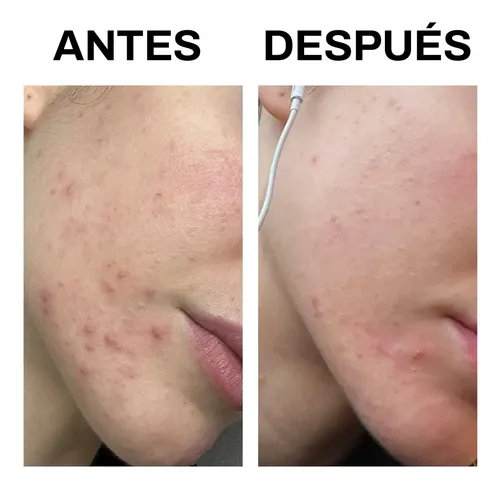 Shilajit Suero Rostro Niacinamida Maquillaje Prolijo 30 Ml