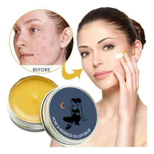 Bálsamo Para El Cuidado De La Piel Facial, Acné Y Enrojecimi