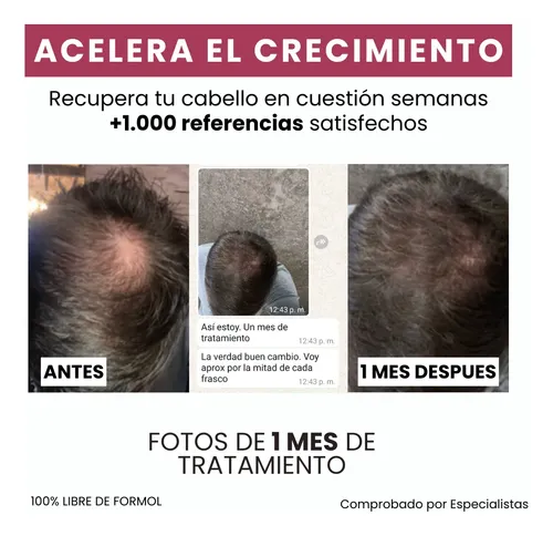 Biotina Capilar X1 Litro, Funda De Saten O Seda Anti Frizz